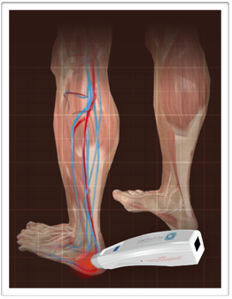 laser therapy pain relief